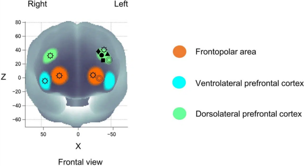 A schematic of the brain showing different areas like frontopolar area.